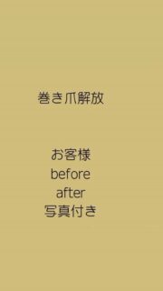 　　　　　　　nailsalon fu ^a

長時間歩くと痛い
巻き爪じゃないけど、何か痛い

爪周りの角質ケアでその痛みが
なくなることもあります。

#福井市ネイルサロン #巻き爪補正ができるネイルサロン #フットジェルネイル #フィルインジェル #福井市松本
